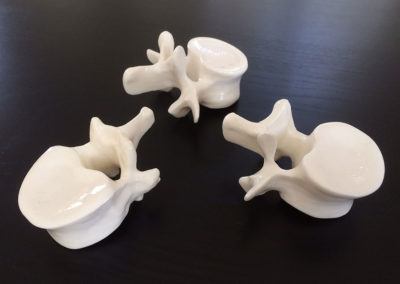 Vertebres 3D